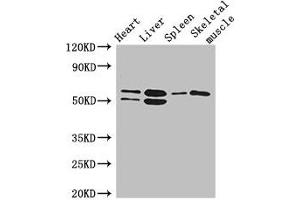 Western Blot Positive WB detected in: Mouse heart tissue, Mouse liver tissue, Mouse spleen tissue, Mouse skeletal muscle tissue All lanes: SLC15A3 antibody at 5 μg/mL Secondary Goat polyclonal to rabbit IgG at 1/50000 dilution Predicted band size: 64 kDa Observed band size: 64, 50 kDa (SLC15A3 Antikörper  (AA 253-309))