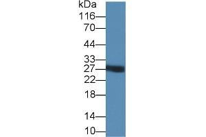 Detection of TRY in PANC1 cell lysate using Polyclonal Antibody to Trypsin (TRY) (Trypsin Antikörper  (AA 9-231))