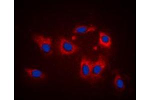 Immunofluorescent analysis of LATH staining in K562 cells. (LATH Antikörper  (Center))