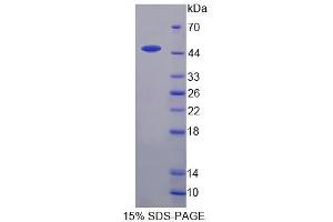 Image no. 1 for Bone Morphogenetic Protein 8B (BMP8) (AA 20-399) protein (His tag) (ABIN6236833) (BMP8B Protein (AA 20-399) (His tag))