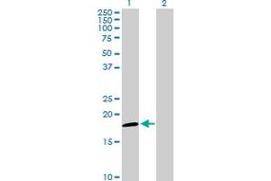 Western Blotting (WB) image for anti-NADH Dehydrogenase (Ubiquinone) 1, alpha/beta Subcomplex, 1, 8kDa (NDUFAB1) (AA 1-156) antibody (ABIN518233)