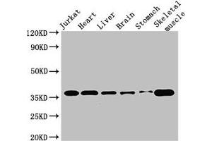 Western Blot Positive WB detected in: Jurkat whole cell lysate, Mouse heart tissue, Mouse brain tissue, Mouse kidney tissue, Mouse stomach tissue, Mouse skeletal muscle tissue All lanes: USE1 antibody at 2.