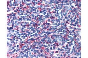 Anti-GPR44 / CRTH2 antibody IHC of human tonsil. (Prostaglandin D2 Receptor 2 (PTGDR2) (Extracellular Domain) Antikörper)