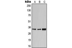 Western blot analysis of CD1e expression in HeLa (A), SP2/0 (B), H9C2 (C) whole cell lysates. (CD1e Antikörper  (Center))