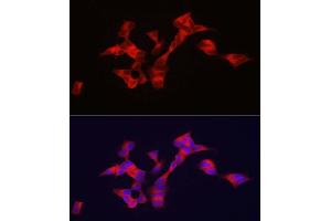 Immunofluorescence analysis of SH-SY5Y cells using BSCL2 antibody (ABIN7265874) at dilution of 1:100.