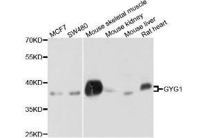 Western blot analysis of extract of various cells, using GYG1 antibody. (Glycogenin 1 Antikörper)