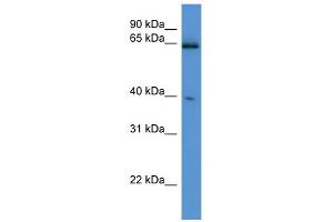 WB Suggested Anti-Asrgl1 Antibody Titration: 0. (ASRGL1 Antikörper  (C-Term))