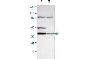 Western blot analysis of Lane 1: Human cell line RT-4; Lane 2: Human cell line U-251MG sp with DSN1 polyclonal antibody  at 1:100-1:250 dilution.