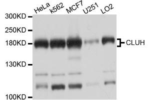 Western blot analysis of extracts of various cell lines, using CLUH antibody (ABIN6003838) at 1/1000 dilution. (CLUH Antikörper)