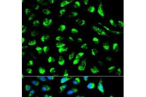 Immunofluorescence analysis of HeLa cells using ECI1 Polyclonal Antibody (DCI Antikörper)