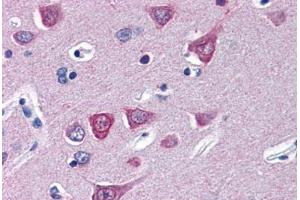 Human Brain, Cortex (formalin-fixed, paraffin-embedded) stained with SOCS1 antibody ABIN343904 at 5 ug/ml followed by biotinylated goat anti-rabbit IgG secondary antibody ABIN481713, alkaline phosphatase-streptavidin and chromogen. (SOCS1 Antikörper  (N-Term))