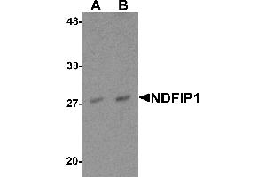 Western blot analysis of NDFIP1 in PC-3 cell lysate with NDFIP1 antibody at (A) 0.