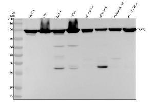 Western blot analysis of TRPV5 using anti-TRPV5 antibody (ABIN7606596).