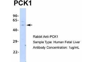 Host:  Rabbit  Target Name:  PCK1  Sample Type:  Human Fetal Liver  Antibody Dilution:  1.