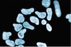 Immunofluorescence staining of HeLa cells (Human cervical epitheloid carcinoma, ATCC CCL-2. (XRCC5 Antikörper  (AA 103-315))