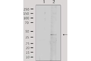 Western blot analysis of extracts from rat brain, using Collagen IV α2 Antibody. (COL4a2 Antikörper  (N-Term))