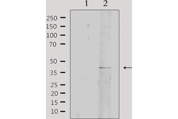 COL4a2 antibody  (N-Term)