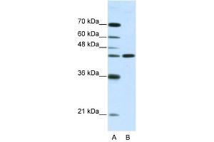 NMUR2 antibody used at 2. (NMUR2 Antikörper  (N-Term))