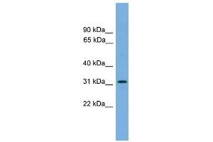DAPP1 antibody used at 1 ug/ml to detect target protein. (DAPP1 Antikörper  (Middle Region))