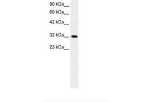 Image no. 1 for anti-E2F5 (E2F5) (AA 134-183) antibody (ABIN6736272)