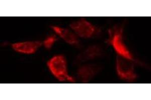ABIN6274752 staining HuvEc cells by IF/ICC. (RPS20 Antikörper  (Internal Region))