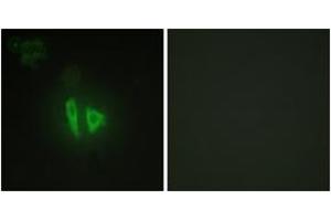 Immunofluorescence analysis of HepG2 cells, using AKAP11 Antibody. (AKAP11 Antikörper  (AA 1761-1810))