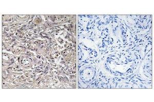 Immunohistochemistry (IHC) image for anti-Claudin 6 (CLDN6) (Internal Region) antibody (ABIN1851126) (Claudin 6 Antikörper  (Internal Region))