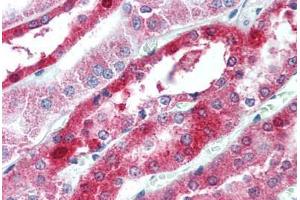 Human Kidney (formalin-fixed, paraffin-embedded) stained with OCLN antibody ABIN305888 at 2. (Occludin Antikörper  (C-Term))