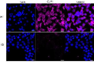 Immunocytochemical staining of HeLa cells using CLIP1 antibody (ABIN7797861), 1:1,000), Top panel: wild-type (WT), Bottom panal: CLIP1 shRNA knockdown (KD).