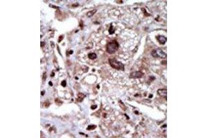 Image no. 1 for anti-serine threonine Kinase 39 (STK39) (Middle Region) antibody (ABIN360385) (STK39 Antikörper  (Middle Region))