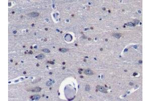 Detection of Grb7 in Porcine Cerebrum Tissue using Polyclonal Antibody to Growth Factor Receptor Bound Protein 7 (Grb7) (GRB7 Antikörper  (AA 66-327))