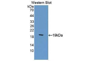 Western blot analysis of the recombinant protein. (Calcitonin Receptor Antikörper  (AA 42-170))