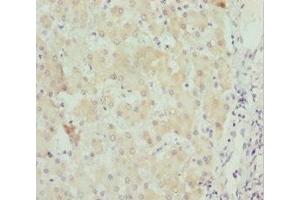 Immunohistochemistry of paraffin-embedded human liver tissue using ABIN7171258 at dilution of 1:100 (STXBP2 Antikörper  (AA 1-280))