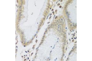Immunohistochemistry of paraffin-embedded human stomach using ENPEP antibody  at dilution of 1:200 (40x lens). (ENPEP Antikörper  (AA 708-957))
