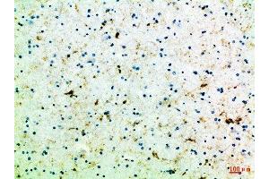 Immunohistochemical analysis of paraffin-embedded Human-brain, antibody was diluted at 1:100 (FZD4 Antikörper  (AA 11-60))