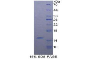 SDS-PAGE (SDS) image for Neurogenin 3 (NEUROG3) (AA 93-214) protein (His tag) (ABIN1877404)