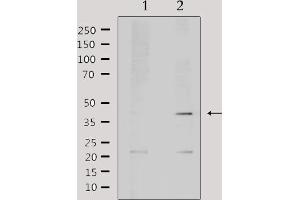 Western blot analysis of extracts from mouse brain, using AIM2 Antibody.