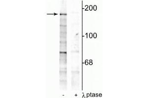 Western blot of rat hippocampal lysate showing specific immunolabeling of the ~180 kDa NR2B subunit phosphorylated at Tyr1252 in the first lane (-). (GRIN2B Antikörper  (pTyr1252))
