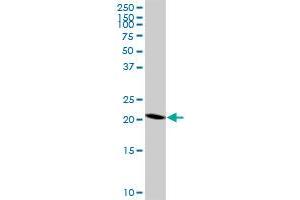 RNF182 polyclonal antibody (A01), Lot # 060802QCS1. (RNF182 Antikörper  (AA 1-99))