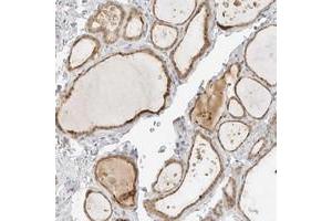 Immunohistochemical staining of human thyroid gland with NEO1 polyclonal antibody  shows moderate cytoplasmic positivity in glandular cells at 1:10-1:20 dilution. (NEO1 Antikörper)