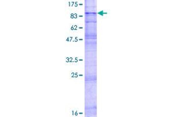 SLC22A2 Protein (AA 1-555) (GST tag)