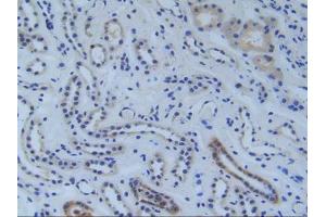 Figure. (RFTN1 Antikörper  (AA 288-520))