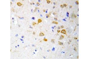 IHC-P: 5HT2A Receptor antibody testing of rat brain tissue (HTR2A Antikörper  (C-Term))