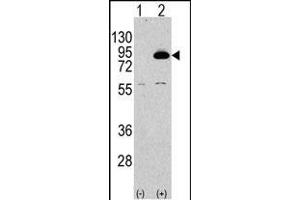 Western blot analysis of PIK3R2 Antibody (N-term) polyclonal antibody (ABIN392580 and ABIN2842115) (arrow). (PIK3R2 Antikörper  (N-Term))