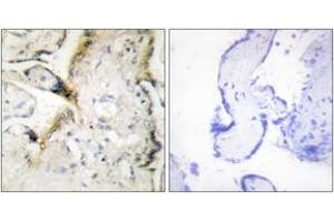 Immunohistochemistry analysis of paraffin-embedded human placenta tissue, using LAMA2 Antibody. (Laminin Antikörper  (AA 2011-2060))