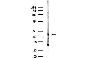 anti-AChE Q Subunit (COLQ) (Internal Region) antibody