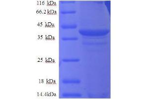 Cytochrome B5 Type A (Microsomal) (CYB5A) (AA 2-97), (partial) protein (GST tag) (Cytochrome b5 (CYTB5) (AA 2-97), (partial) protein (GST tag))