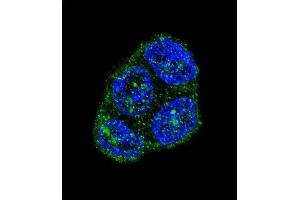 Confocal immunofluorescent analysis of FAS Antibody (Center) (ABIN652469 and ABIN2842320) with T47D cell followed by Alexa Fluor 488-conjugated goat anti-rabbit lgG (green). (FAS Antikörper  (AA 185-211))