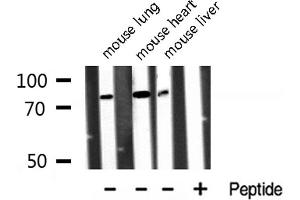 Western blot analysis of Annexin A6 expression in various lysates.