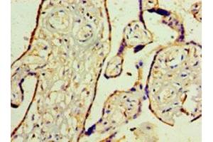 Immunohistochemistry (IHC) image for anti-Wilms Tumor 1 (WT1) (AA 1-449) antibody (ABIN7175818)